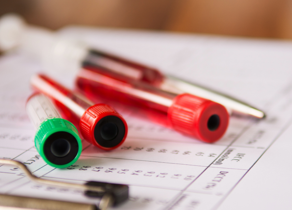 Jakie badania należy wykonać w celu zdiagnozowania insulinooporności?